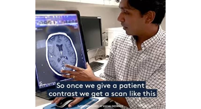 Gamma Knife complex brain scan