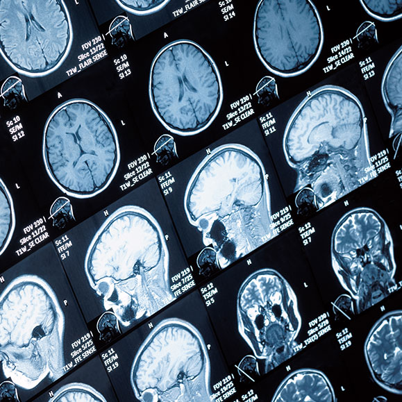 Brain scan stock image