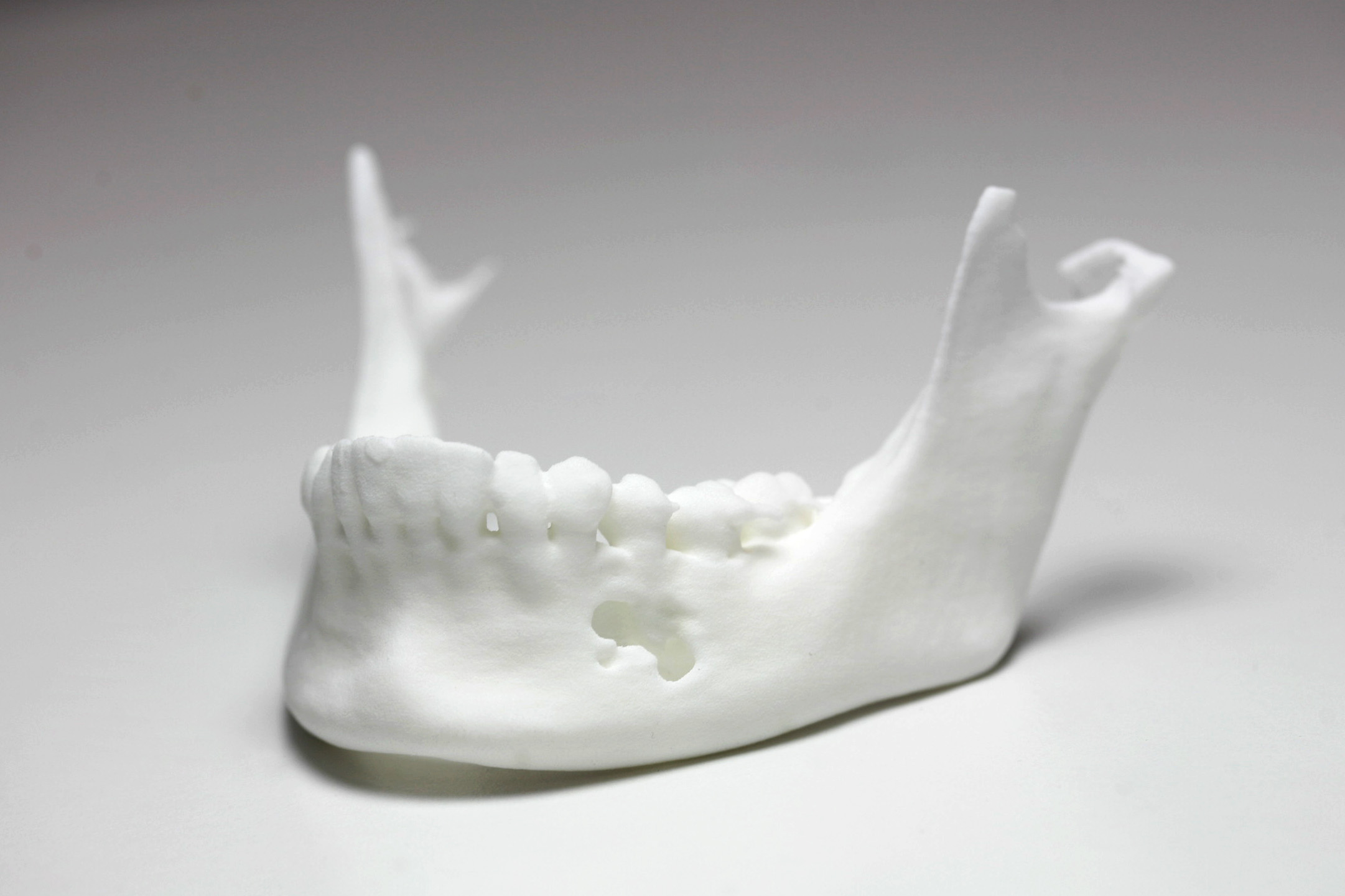 Jaw - Head neck and thyroid
