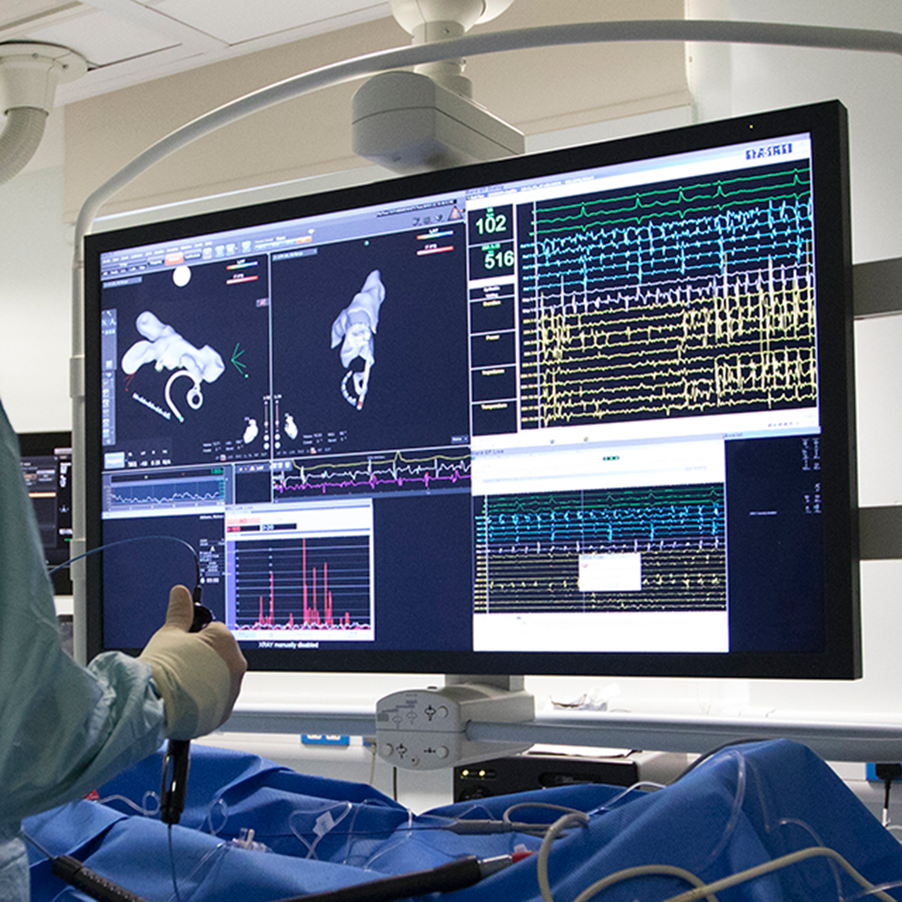 Interventional-caridology